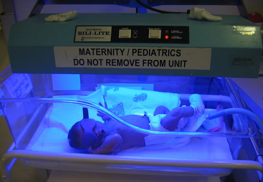 Neonatal phototherapy unit for newborn jaundice